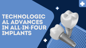 Technological Advances in All-in-Four Implants