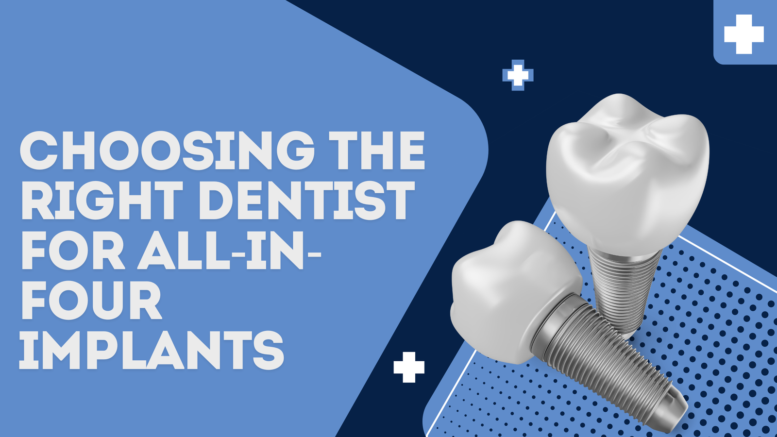 Choosing the Right Dentist for All-in-Four Implants